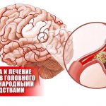 Treatment of vascular diseases, Cleansing of blood vessels