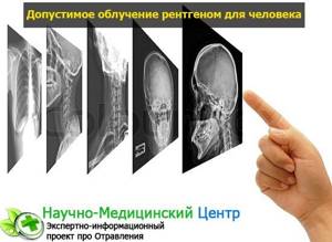 Рентгеновское излучение: воздействие на человека, польза и вред, применение